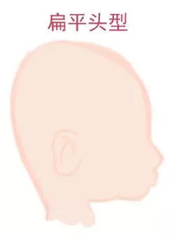 宝宝圆头好照旧扁头好？？？？？？这些神秘许多爸妈都不知道4.webp.jpg