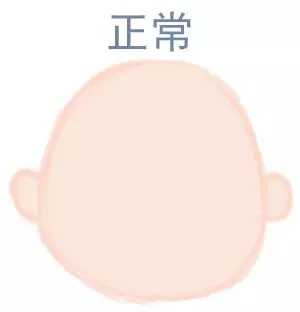 宝宝圆头好照旧扁头好？？？？？？这些神秘许多爸妈都不知道5.webp.jpg