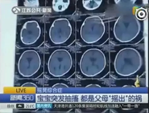 多名婴儿脑出血，，，，，，，，家长一个不经意的行动竟然对宝宝危险这么大1.webp.jpg